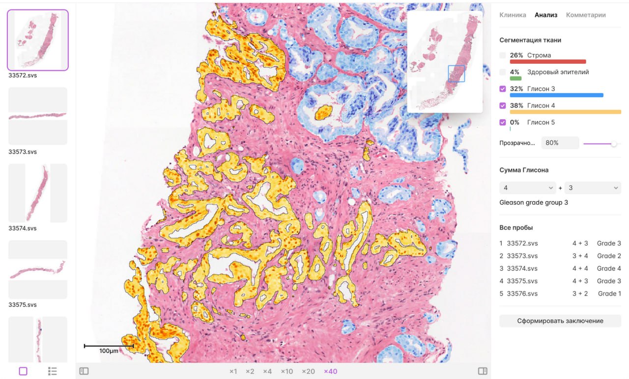  Ростех купил четверть компании-разработчика ИИ-решений для диагностики онкологии.