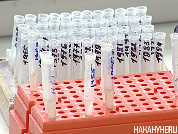 ВИЧ-пациенты в регионах РФ столкнулись с отказами в диагностике